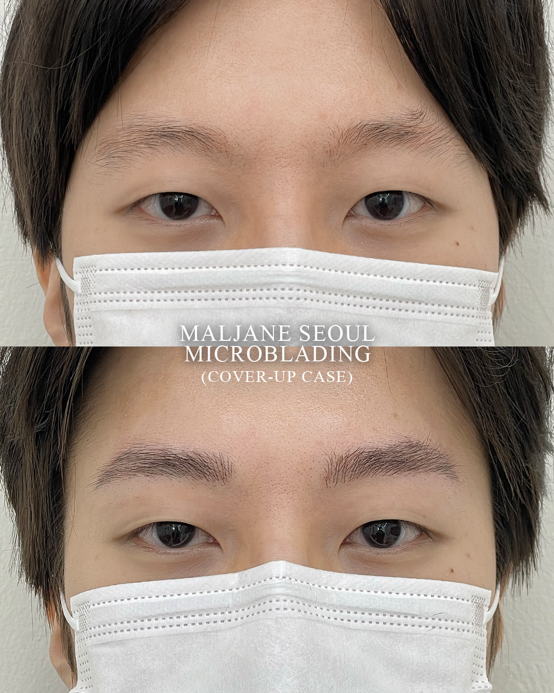 Microblading cover-up before and after for faded old brow tattoo pigment at MALJANE SEOUL
