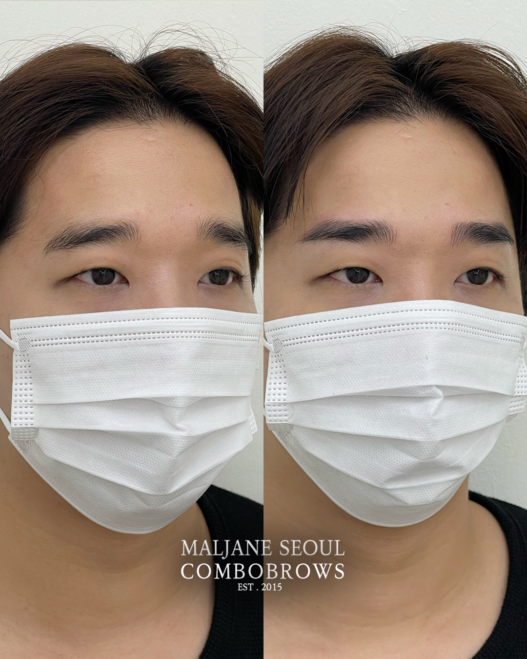 Men’s Combo Brows Seoul before and after at MALJANE for a client with downward-drooping brow tails